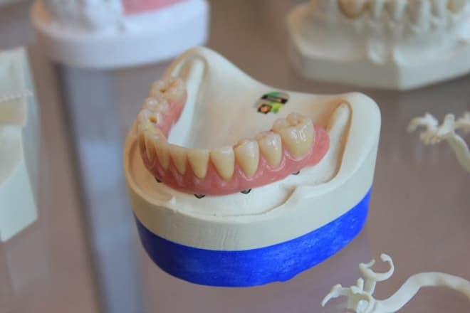 Dentures-min