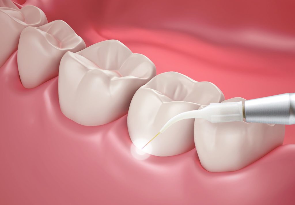 Periodontal Gum Specialist in Delta, BC