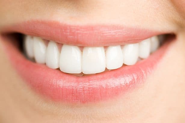 teeth-nice