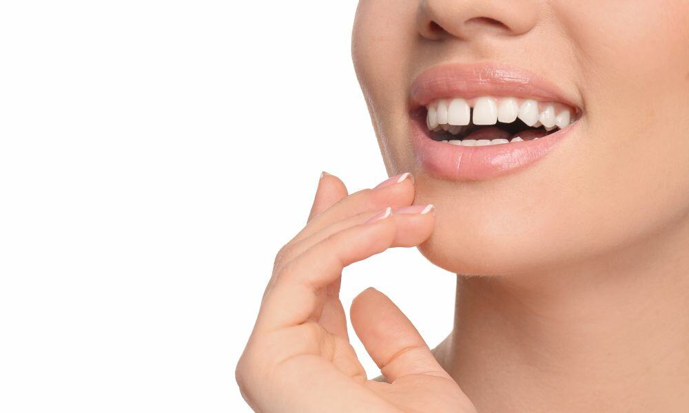 teeth whitening