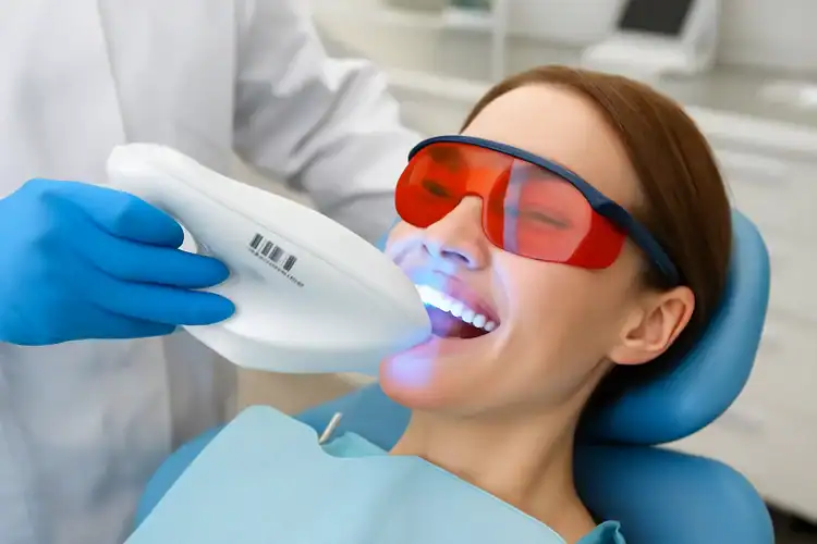 dentist applying teeth whitening, representing teeth whitening aftercare tips