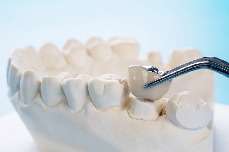 CDCP Coverage for Crowns