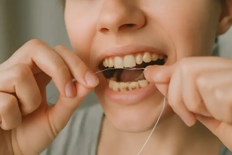 Why do I get cavities even though I brush