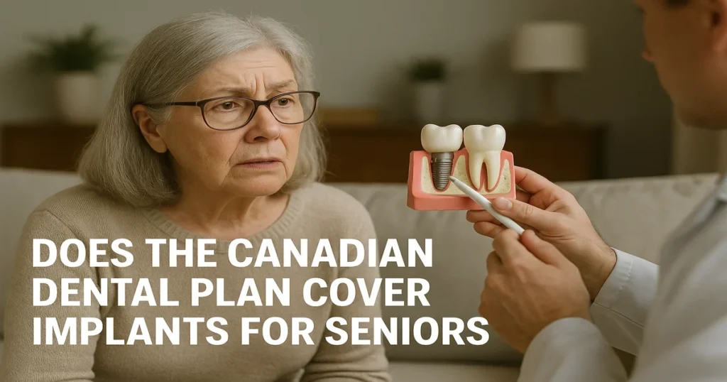 A picture titled Does the Canadian dental plan cover implants for seniors?