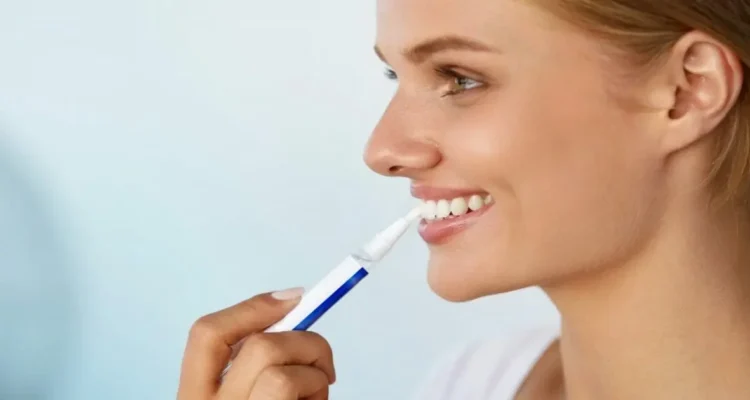 A picture of Dentist-Only Whitening Pens