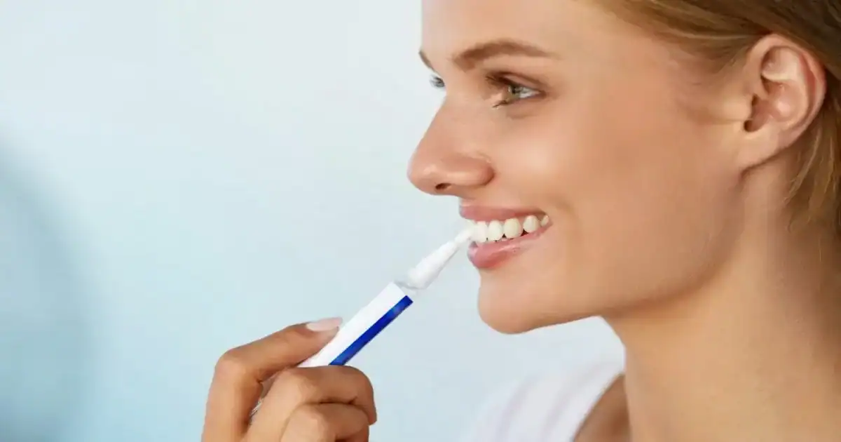 A picture of Dentist-Only Whitening Pens