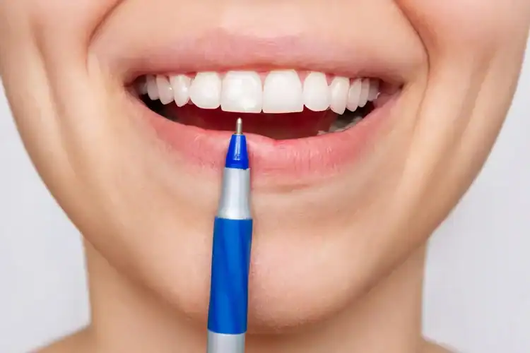 A picture of a woman using a whitening pen