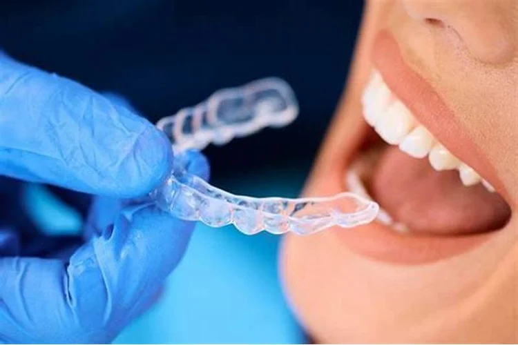 A picture of a dentist putting the patient's invisalign on