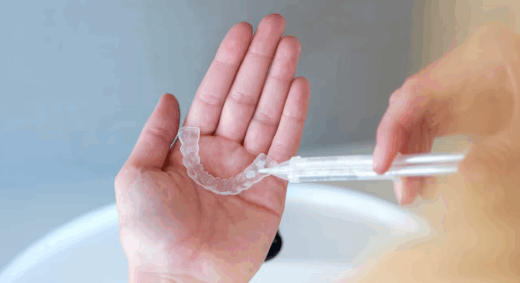 take-home whitening kit