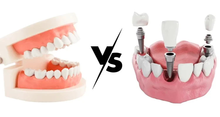 How to choose between dentures and dental implants