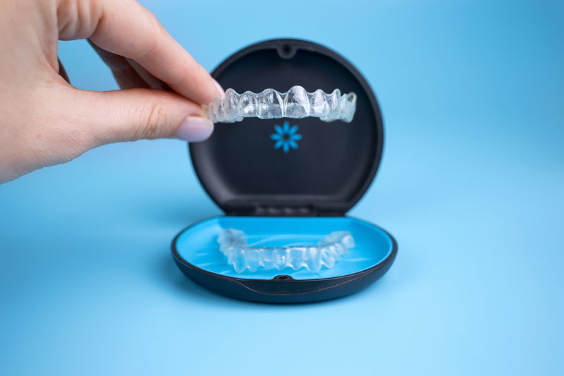 top Invisalign questions