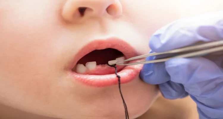 A picture of a child with baby teeth