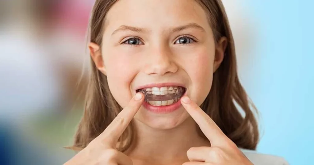 A picture of a child with invisalign