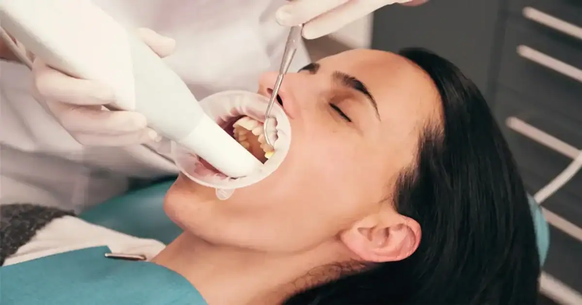 a picture showing deep dental cleaning