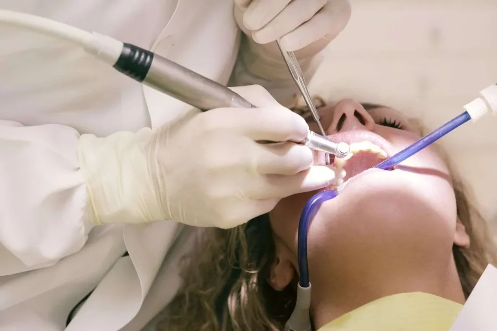 when do you need a deep dental cleaning