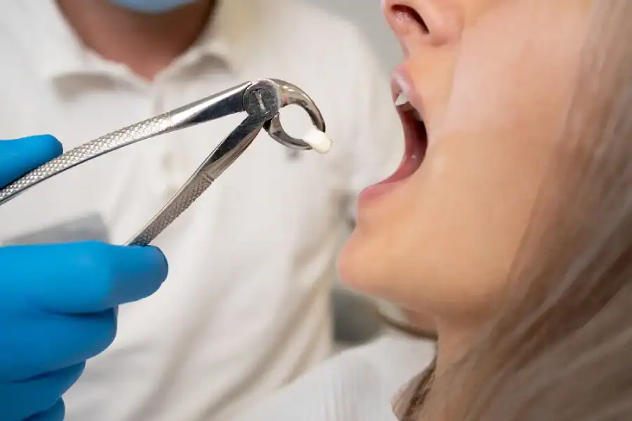 tooth extraction tsawwaseen