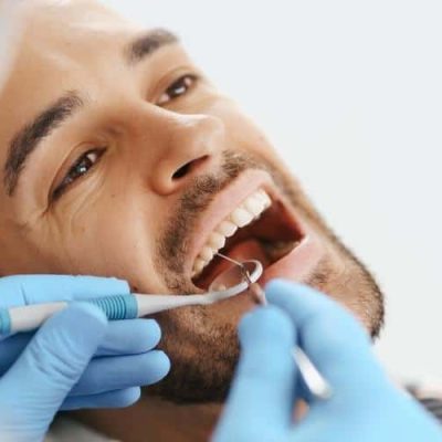 Wisdom Teeth Removal in Delta, BC