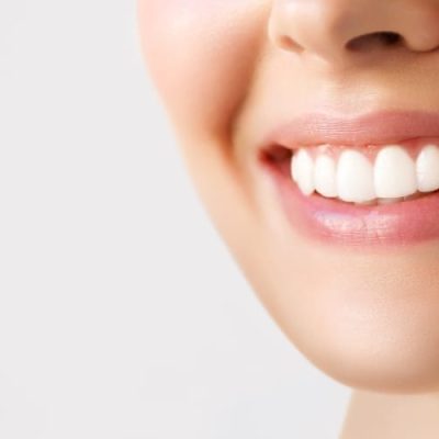 Teeth Whitening in Delta, BC