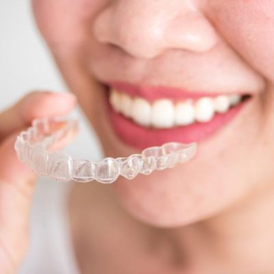 A smiling woman holding invisalign or invisible braces, orthodontic equipment